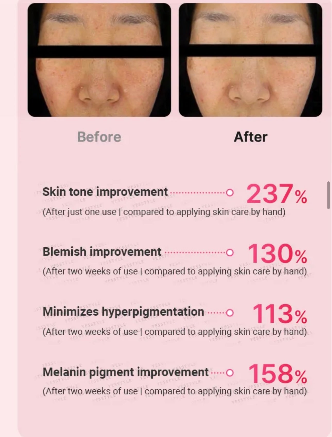 MEDICUBE - AGE-R Booster Pro Mini Pink