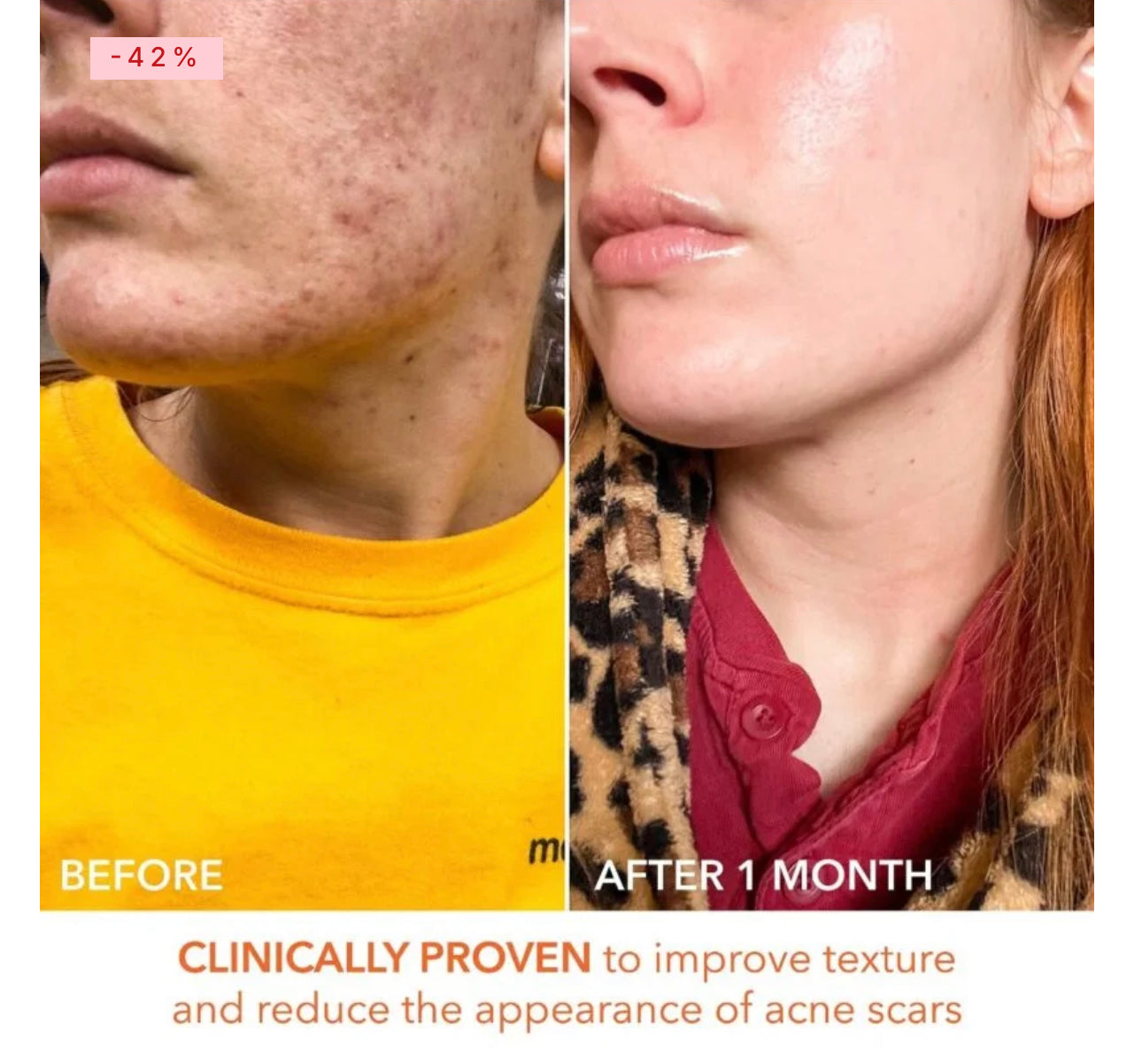 Dr Dennis Gross Alpha Beta Universal Daily Peel Pads 3 Treatments