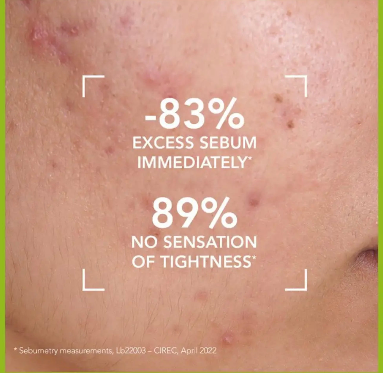 BIODERMA CEBIUM GEL MOSSAN CEBIUM GEL FOR OILY SKIN CLEANING AND ACNE