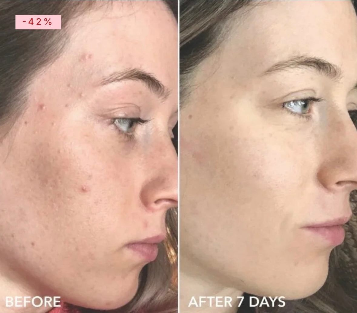 Dr Dennis Gross Alpha Beta Universal Daily Peel Pads 3 Treatments