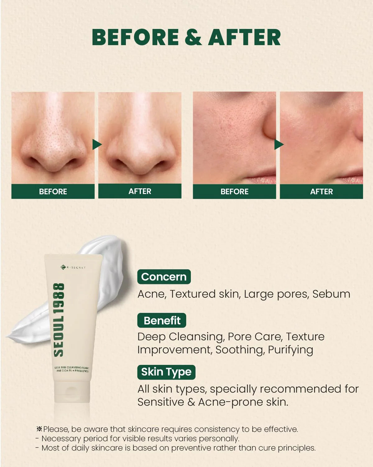 KSECRET SEOUL 1988, Cleansing Foam Pine Cica 1% + Probiotics 150ml