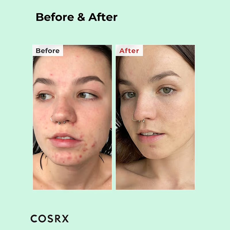 Cosrx, BHA Blackhead Power Liquid 100ml