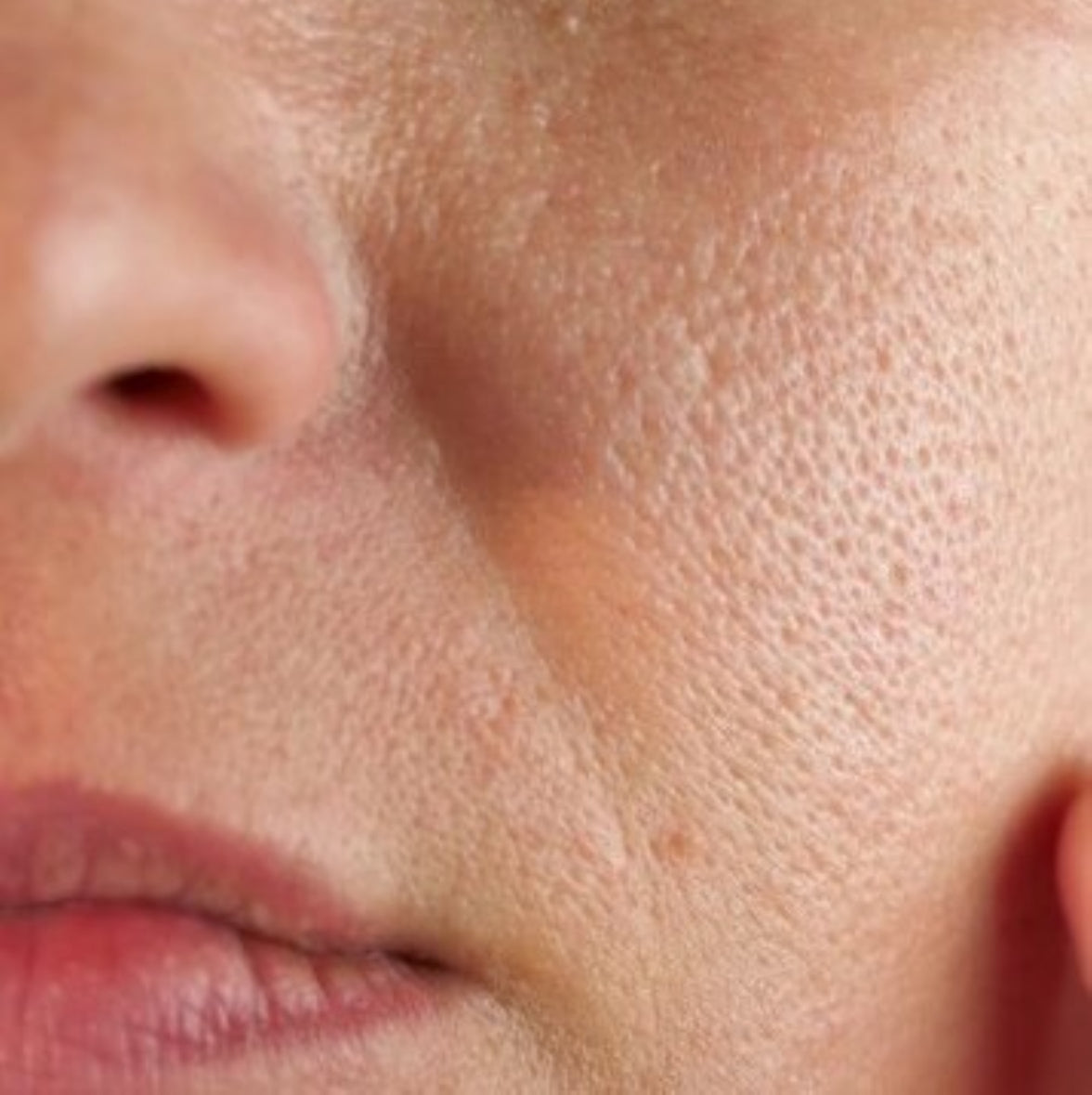 Combination Skin