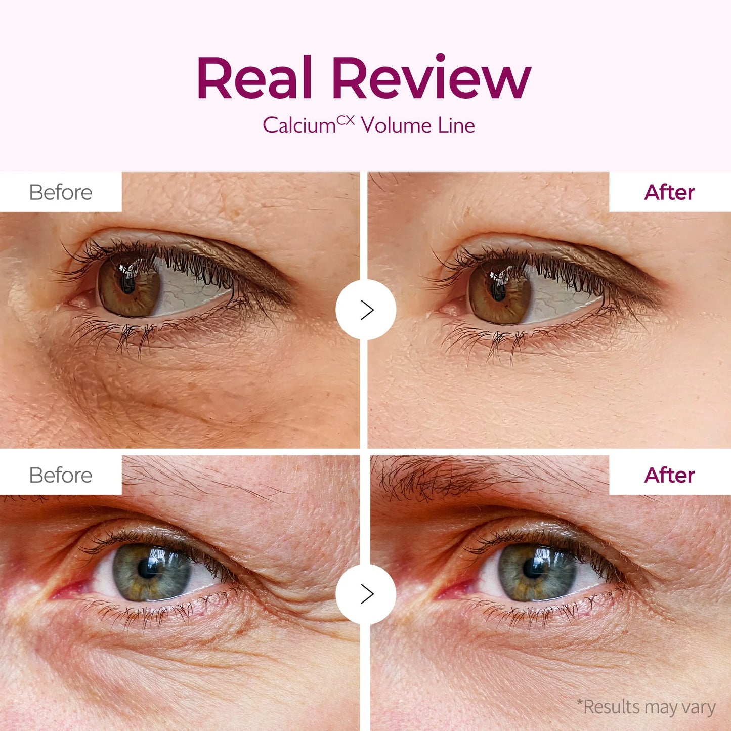 Dr. Melaxin, Cemenrete Calcium Volume Eye Patch 60ea