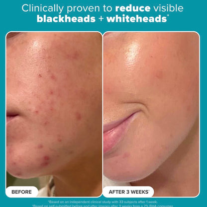 Paula's Choice 2% BHA Exfoliating Toner Pads