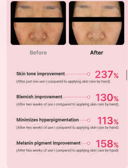 MEDICUBE - AGE-R Booster Pro Mini Pink