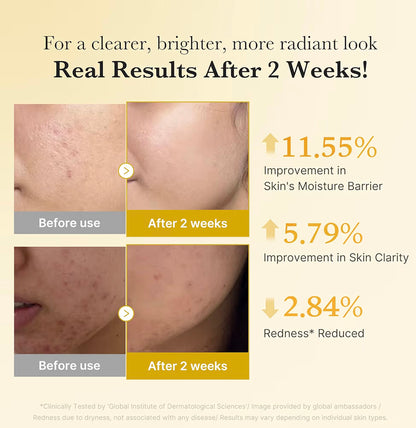 Medicube Kojic Acid Turmeric Niacinamide Serum 30 ml