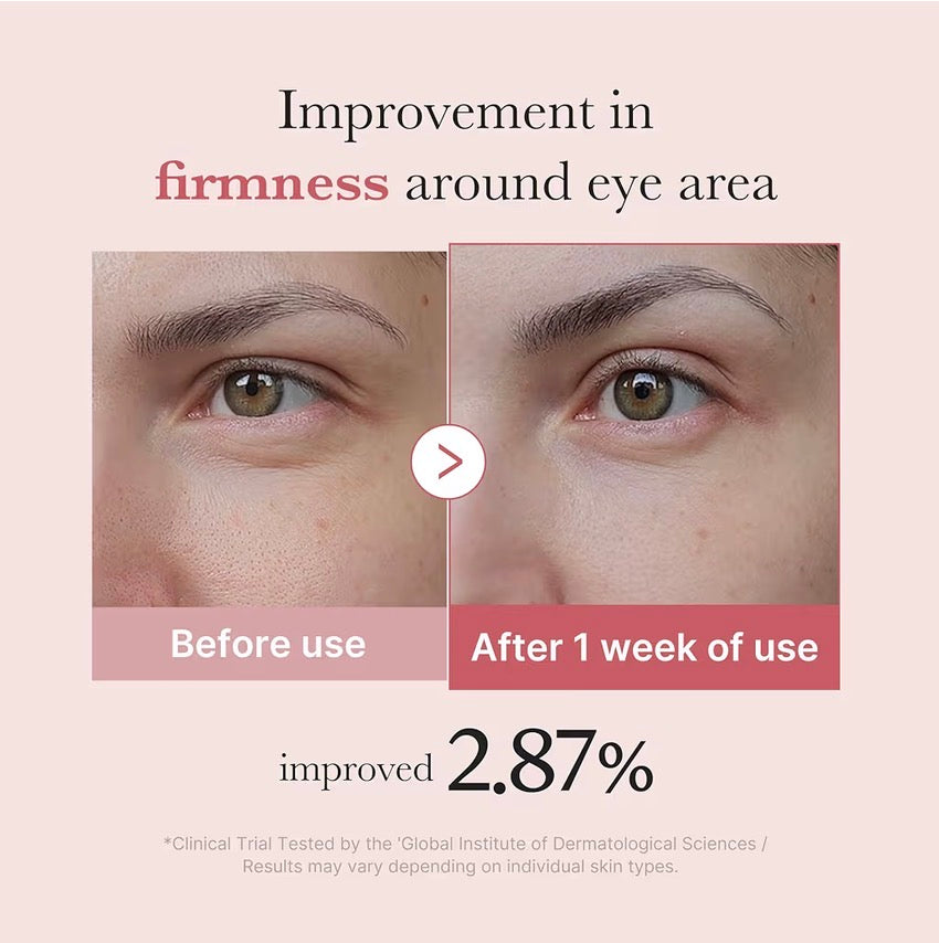 Medicube Salmon DNA PDRN Pink Peptide Eye Serum