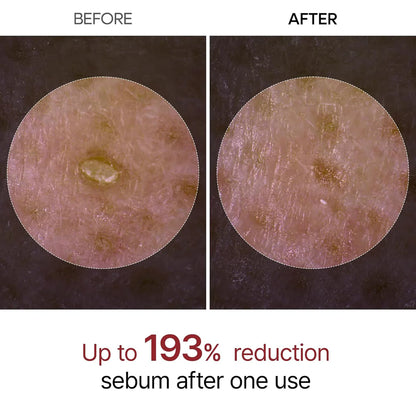 Dr. Melaxin, White Rice Peeling Ampoule for Smoothing and Brightening Skin 80ml