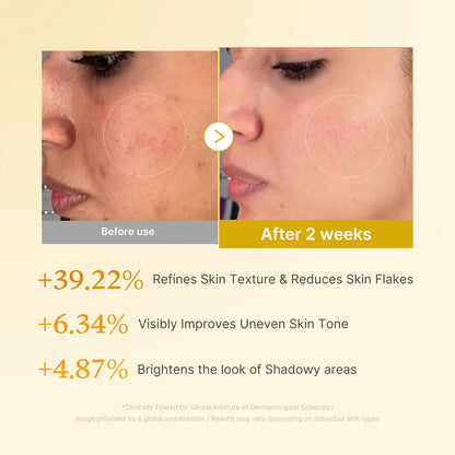 Medicube, Kojic Acid Turmeric Resurfacing Toner 250ml