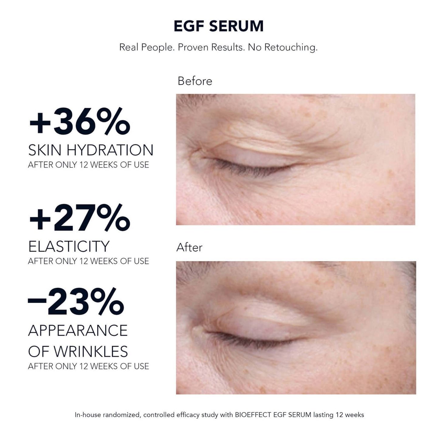 BIOEFFECT, EGF Serum 15ml