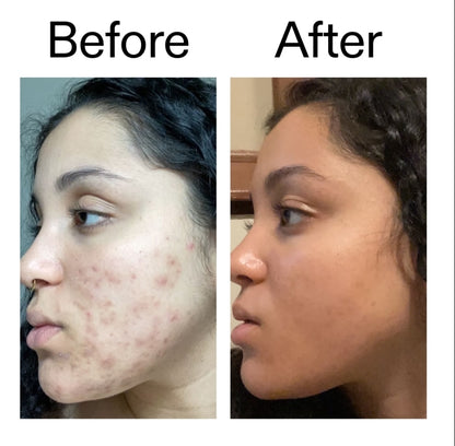 The INKEY List Tranexamic Acid Serum 30ml