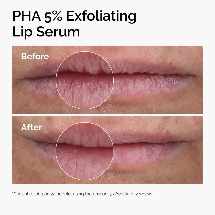 The Ordinary PHA 5% Exfoliating Lip Serum
