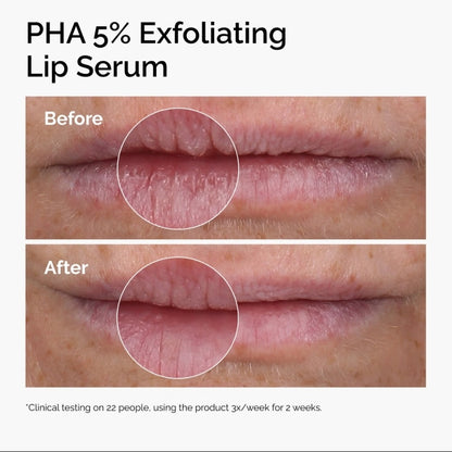 The Ordinary PHA 5% Exfoliating Lip Serum